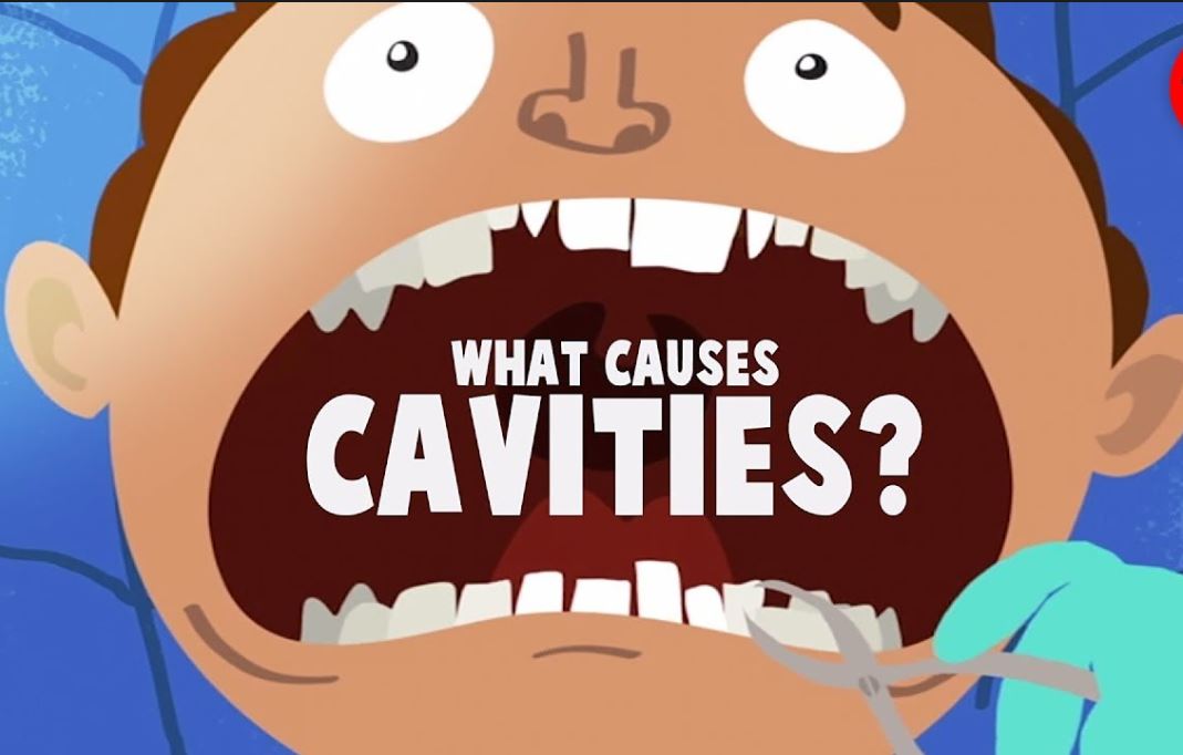 cavities | Lara Village Dental