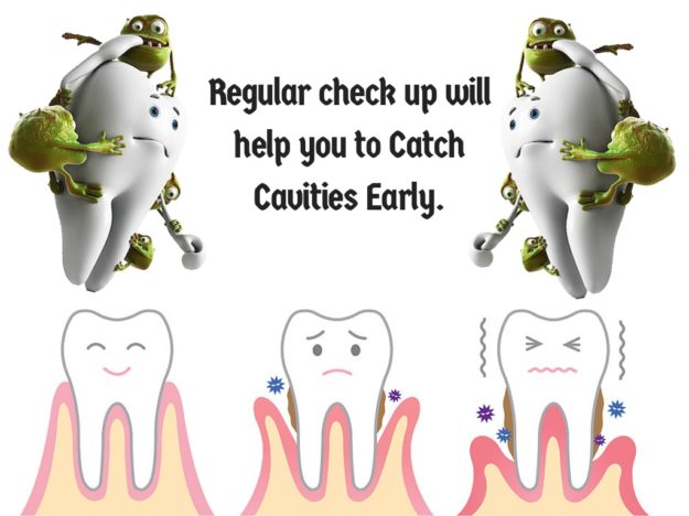 Cavities | Lara Village Dental Cavities | Lara Village Dental