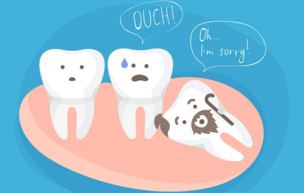 wisdom teeth | Lara Village Dental wisdom teeth | Lara Village Dental