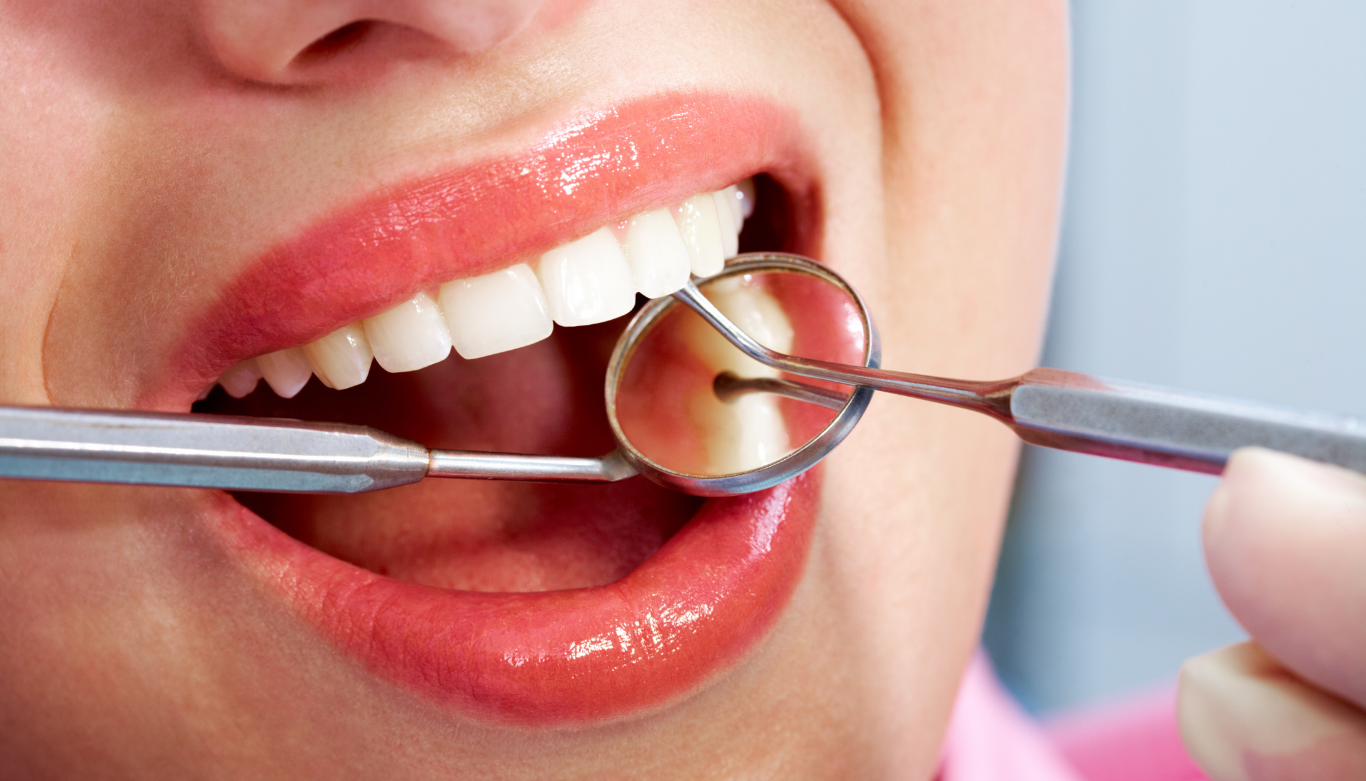 dental-bonding-lara-village-dental